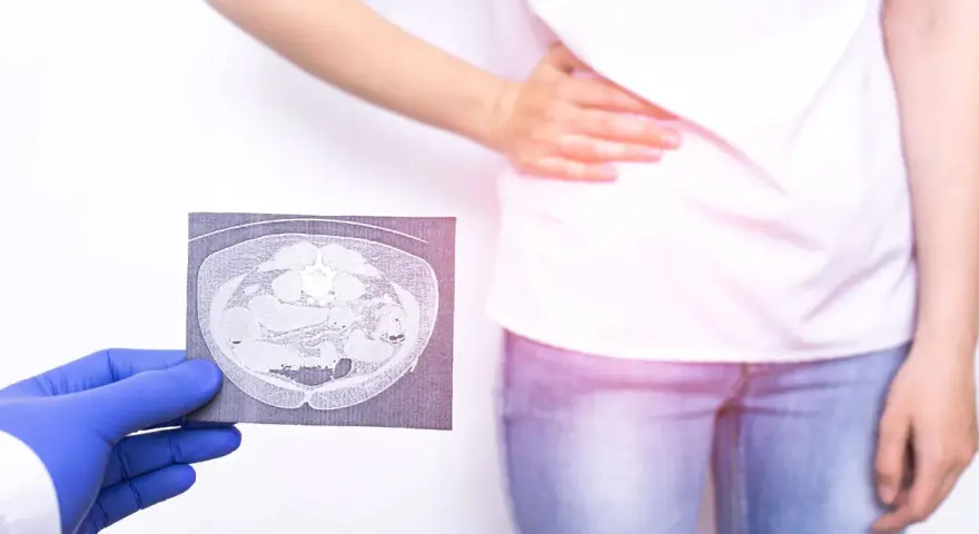 Lekarz w rękawiczce pokazuje tomografię jamy brzusznej osobie z bólem brzucha.