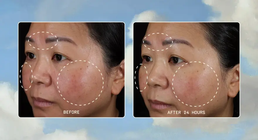 Before and after images show a woman's face with areas of damaged skin barrier highlighted. After 24 hours, the skin appears calmer and less irritated.