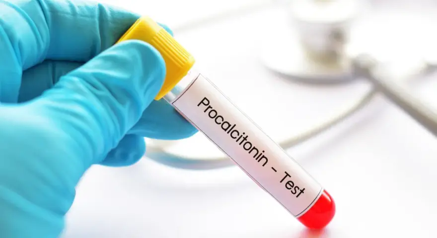 Ręka w niebieskiej rękawiczce trzyma probówkę z napisem "Procalcitonin - Test". To ważny pct.