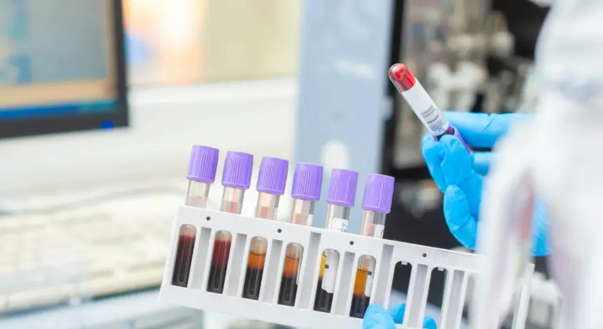 Ręce w niebieskich rękawiczkach trzymają probówki z krwią w stojaku, w tle sprzęt laboratoryjny.