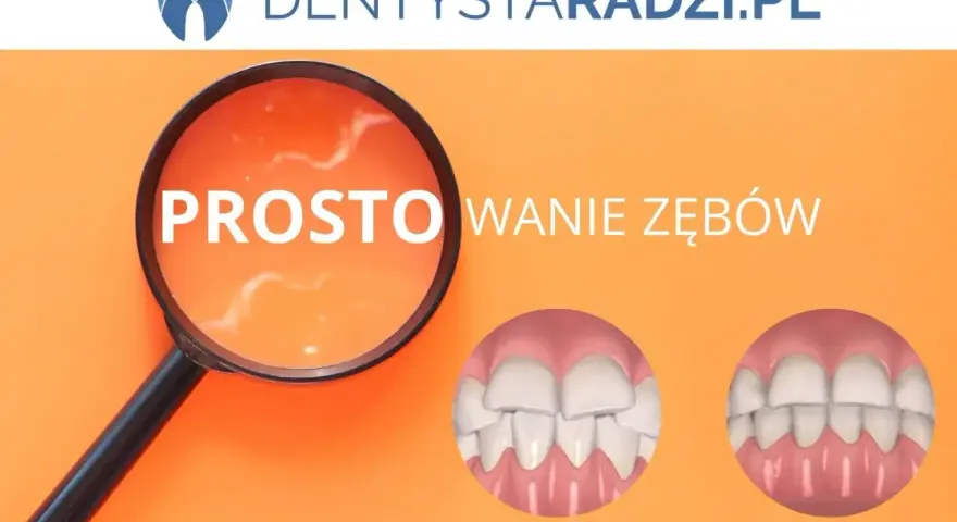 Prostowanie zębów domowymi sposobami: mity, ryzyko i alternatywy