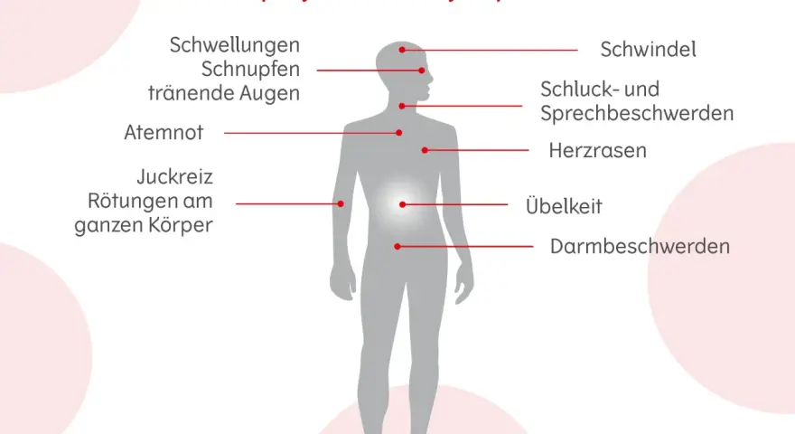 Allergie Symptome: So erkennen Sie gefährliche Reaktionen rechtzeitig