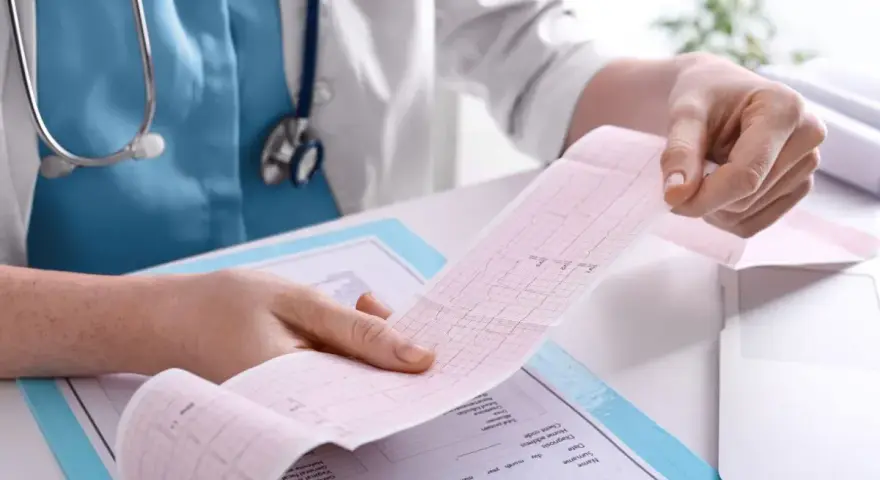 Lekarz analizuje wydruk EKG, pokazujący zapis pracy serca. To kluczowy element, jak się robi EKG i interpretuje wyniki.