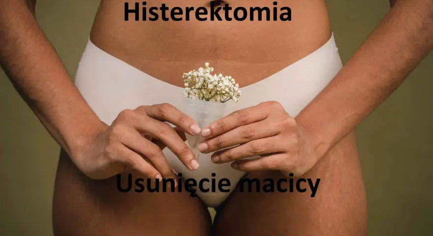 Kobieta trzyma kubeczek menstruacyjny z kwiatami. Napisy "Histerektomia" i "Usunięcie macicy" sugerują temat zabiegu.