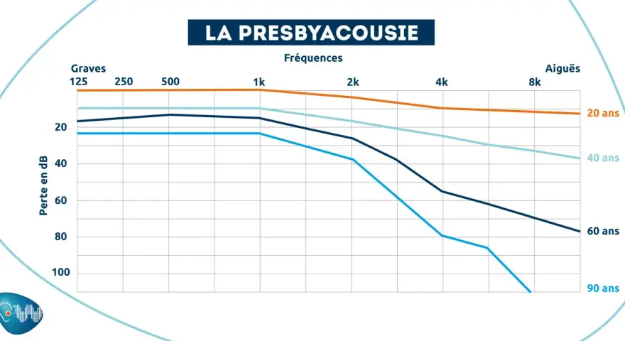 Graphique montrant la perte auditive en décibels selon l'âge et la fréquence. À partir de 20 dB, on entend moins bien.