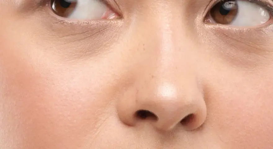 Nahaufnahme eines Gesichts mit braunen Augen und einer normalen Hautstruktur, die leichte Falten um die Augen zeigt.