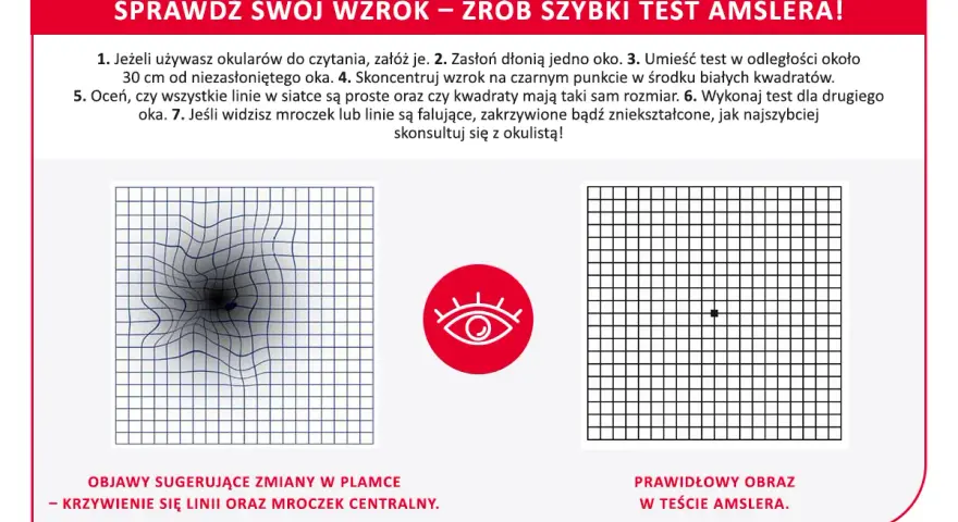 Test Amslera pokazuje zniekształcone linie, sugerując zmiany w plamce żółtej. Domowe sposoby mogą pomóc, ale konsultacja z lekarzem jest kluczowa.