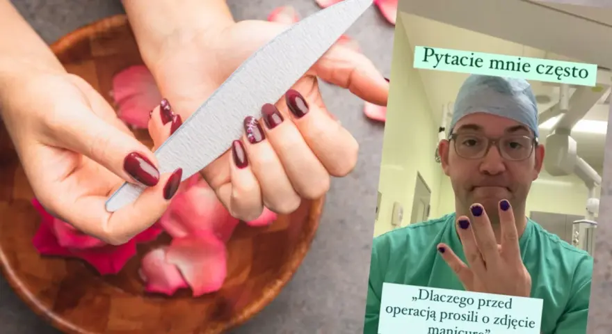 Paznokcie przed operacją? Lekarz w kitlu pokazuje pomalowane paznokcie, odpowiadając na pytanie, czy do operacji można mieć pomalowane paznokcie.