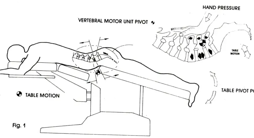 Ilustracja pokazuje technikę manipulacji kręgosłupem, która może pomóc w odpowiedzi na pytanie, czy wypuklina może się cofnąć.