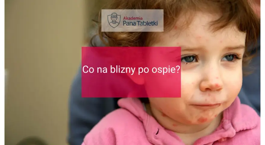 Twarz dziecka z widocznymi śladami po ospie. Napis "Co na blizny po ospie?" sugeruje poszukiwanie rozwiązań.