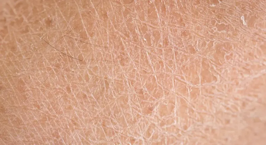 Trockene Gesichtshaut bei Männern: Ursachen, Pflege und effektive Tipps