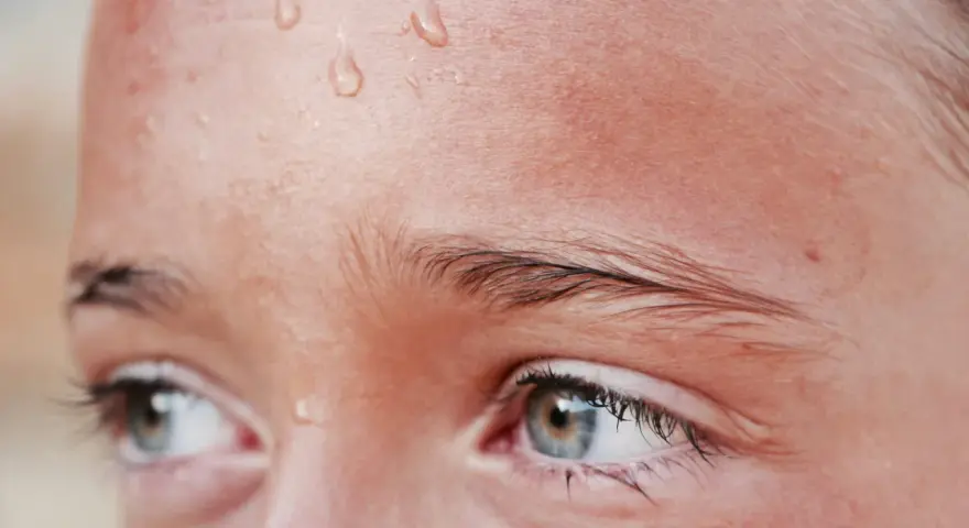Gotas de sudor en la frente de una persona, un síntoma común de hiperhidrosis facial.