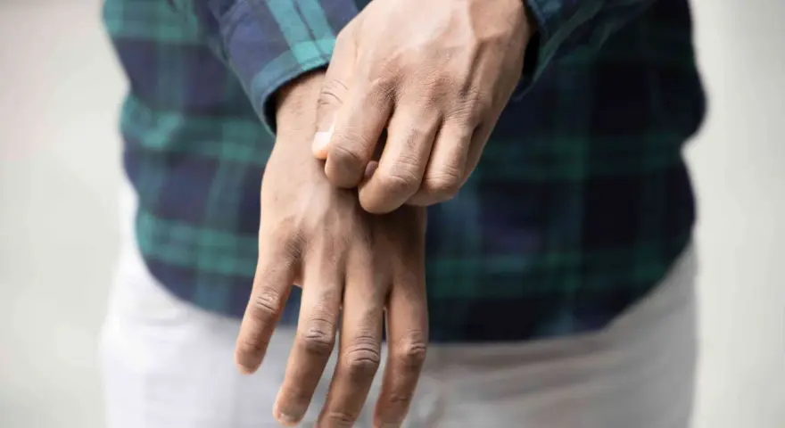 Uomo con camicia a quadri che si gratta il polso, soffrendo di prurito in tutto il corpo.