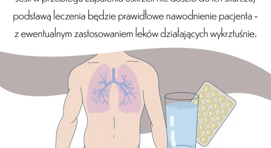 Kiedy hospitalizować dziecko z zapaleniem oskrzeli? Objawy i porady