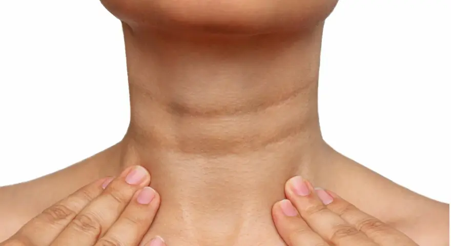Cuello con piel oscura y arrugada, indicativo de acantosis nigricans. Se buscan opciones de tratamiento.