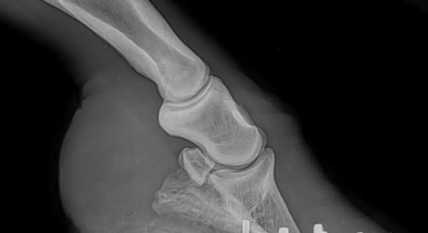 Radiographie d'un pied de cheval montrant une fourbure avec une perforation de la sole.