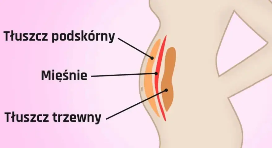 Ilustracja pokazuje przekrój brzucha, gdzie widać jak wygląda tłuszcz na brzuchu: podskórny i trzewny, oddzielone mięśniami.