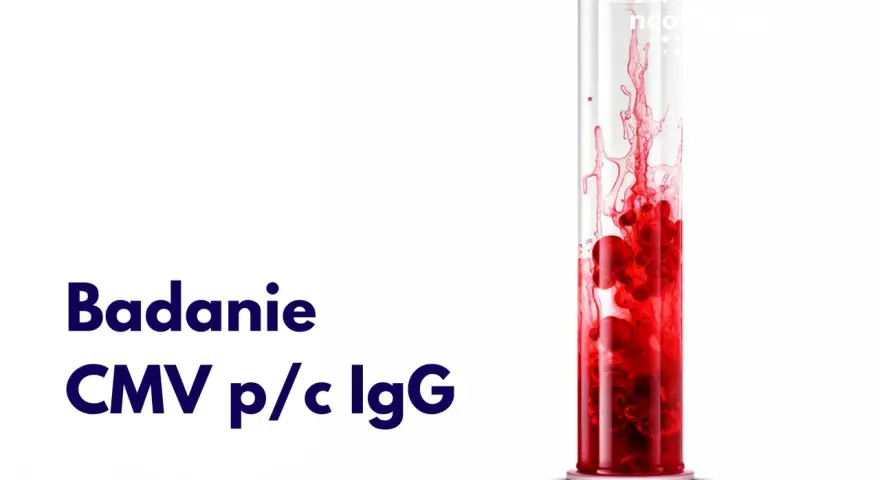 Badanie CMV p/c IgG: wynik dodatni w ciąży. Czerwona substancja w probówce symbolizuje badanie.