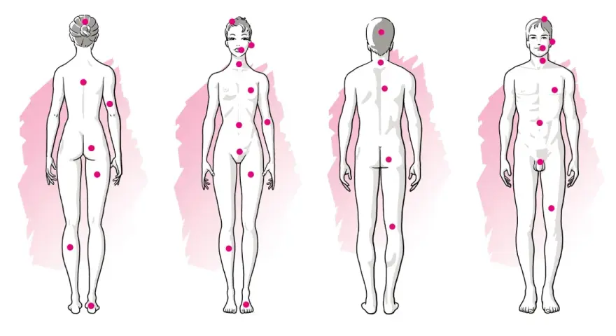 Schémas corporels féminins et masculins avec des points roses indiquant des zones érogènes, suggérant une forte libido.