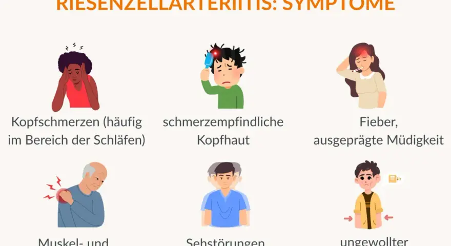 Symptome der Riesenzellarteriitis: Kopfschmerzen, schmerzempfindliche Kopfhaut, Fieber, Müdigkeit, Muskel-/Gelenkschmerzen, Sehstörungen, ungewollter Gewichtsverlust.