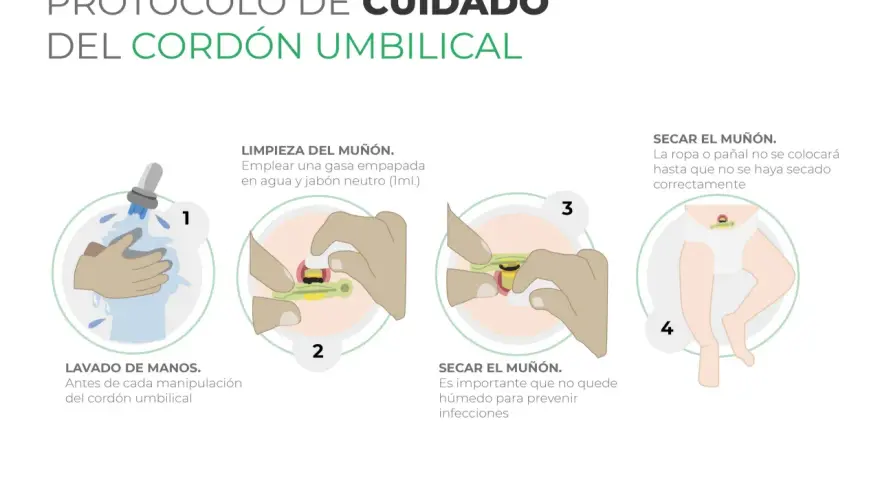 Guía para saber como limpiar el ombligo del bebe: lava manos, limpia el muñón con gasa y jabón neutro, sécalo bien para prevenir infecciones.