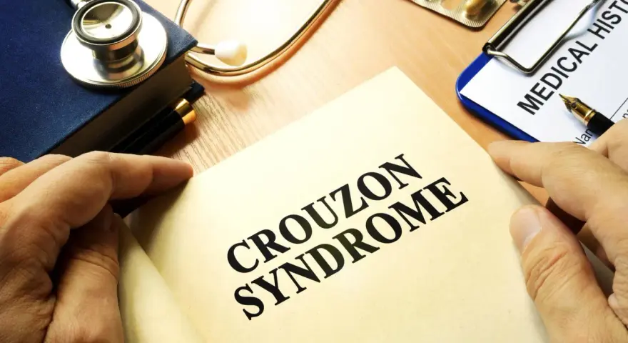 Książka z napisem "CROUZON SYNDROME", stetoskop, dokument "MEDICAL HISTO" i lekarstwa.