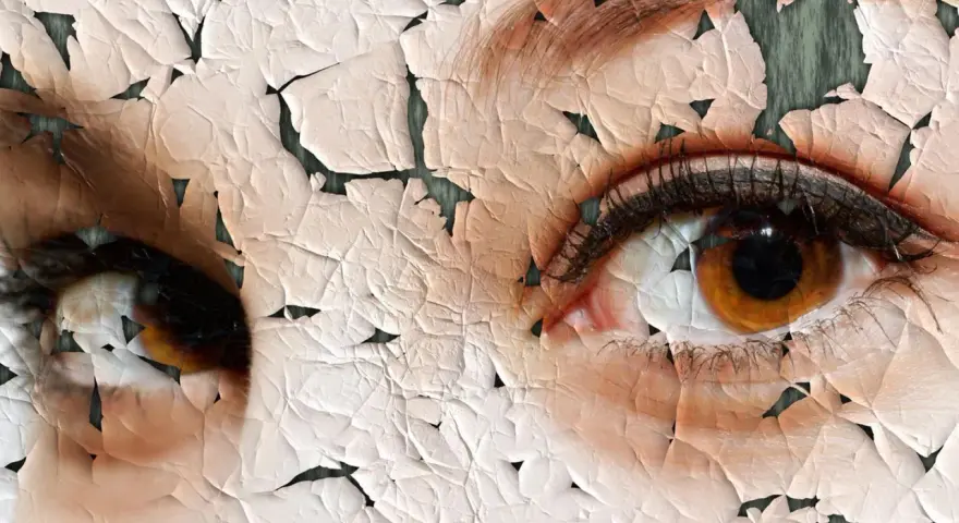 Nahaufnahme von Augen mit rissiger, trockener Haut.