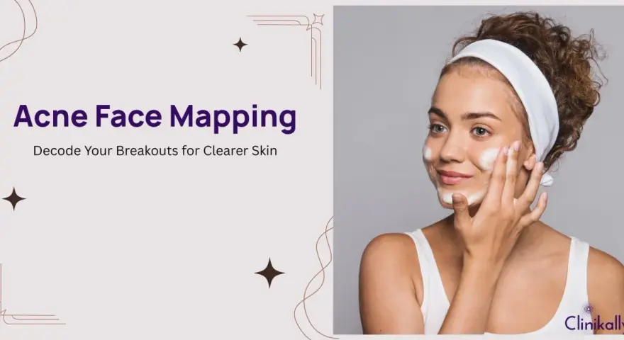 A woman applies foam to her face, illustrating the concept of acne face mapping to understand breakouts.