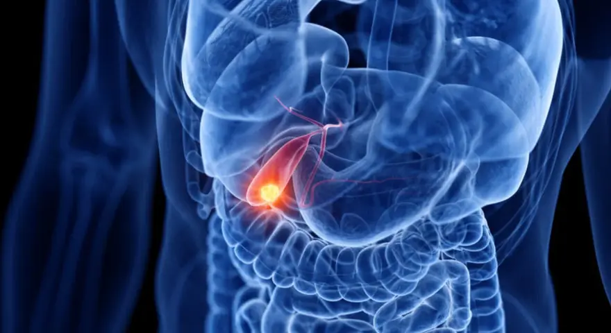 Anatomical rendering of a human torso showing the digestive system. A glowing yellow object, representing a gallstone, is visible within the **woreczek żółciowy**.