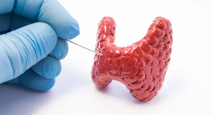 Ręka w niebieskiej rękawiczce wykonuje biopsję tarczycy, pobierając próbkę z czerwonego modelu gruczołu.