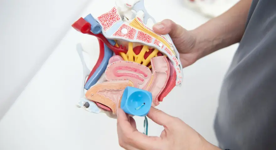 Model anatomiczny narządów miednicy z pessarem w ręku.