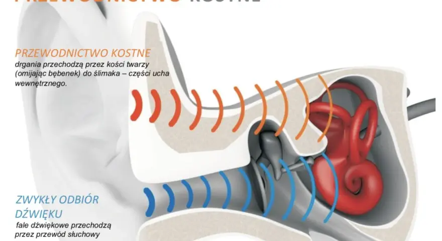 Ilustracja porównuje przewodnictwo kostne (drgania przez kości twarzy do ślimaka) ze zwykłym odbiorem dźwięku.
