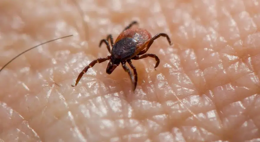 Garrapata en piel humana, un ejemplo de los tipos de garrapatas en España.