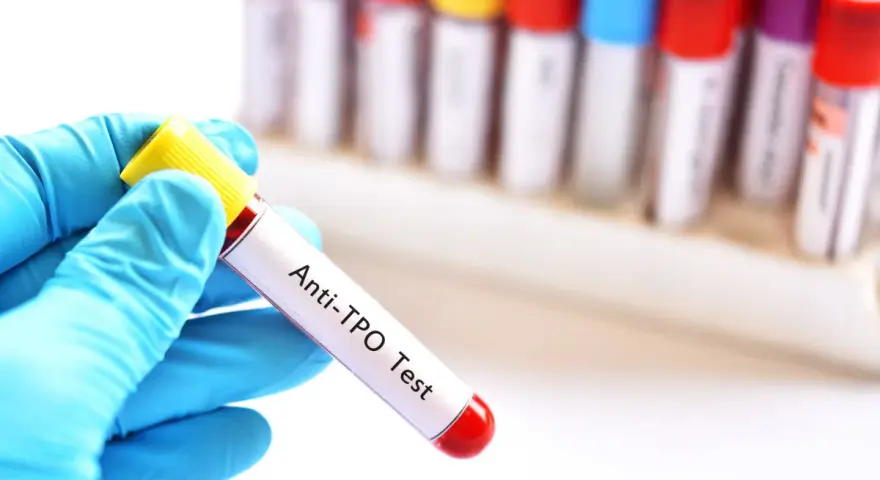 Ręka w niebieskiej rękawiczce trzyma probówkę z krwią do badań immunologicznych u dzieci. Test Anti-TPO.