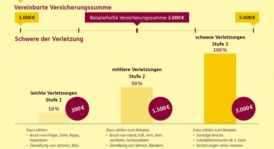 Die ergo unfallversicherung leistungen tabelle zeigt, wie sich Verletzungen auf die Auszahlung auswirken: leichte Verletzungen (Stufe 1) mit 10% bis zu schweren Verletzungen (Stufe 3) mit 100%.