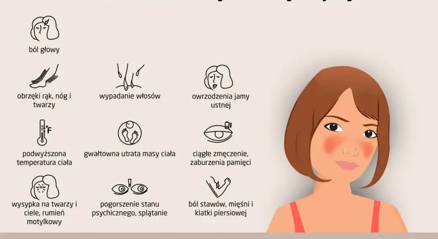 Ilustracja przedstawia objawy tocznia rumieniowatego układowego: ból głowy, obrzęki, wypadanie włosów, owrzodzenia, gorączkę, utratę wagi, zmęczenie, wysypkę motylkową, problemy ze wzrokiem i bóle stawów.