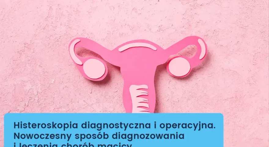 Różowa grafika macicy z jajowodami. Histeroskopia diagnostyczna i operacyjna to nowoczesny sposób diagnozowania i leczenia chorób macicy.