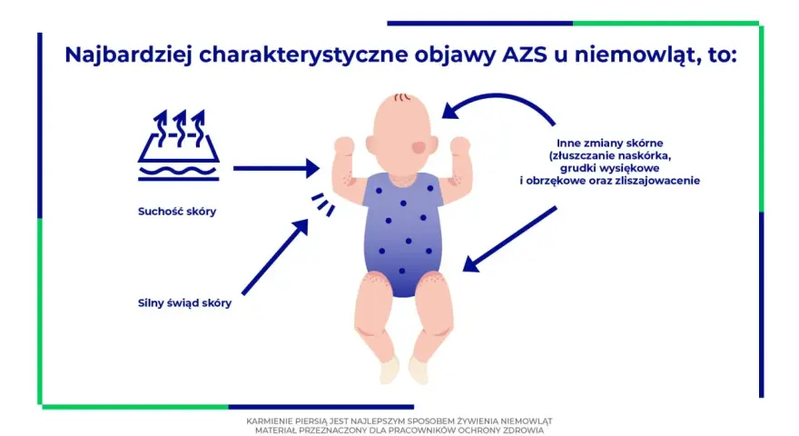 Objawy AZS u niemowląt: suchość i silny świąd skóry, inne zmiany skórne. Karmienie piersią to najlepszy sposób żywienia.