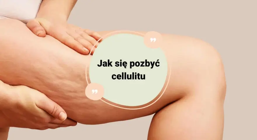 Dłoń dotyka uda z widocznym cellulitem. Tekst w okręgu: "Jak się pozbyć cellulitu".