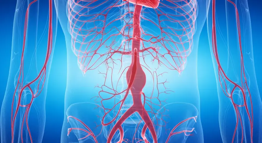 Anatomia aorty brzusznej z widocznym tętniakiem.