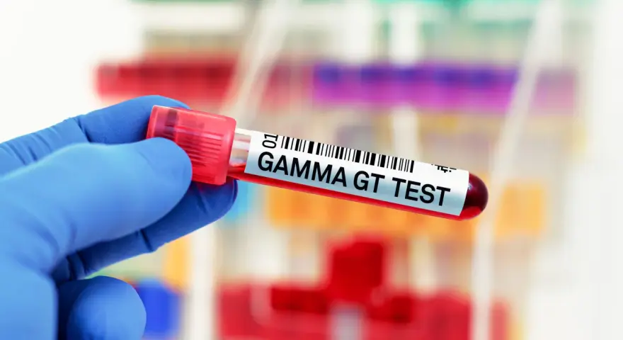 Ręka w niebieskiej rękawiczce trzyma probówkę z krwią oznaczoną "GAMMA GT TEST". To badanie ocenia poziom enzymu gamma-glutamylotranspeptydazy.
