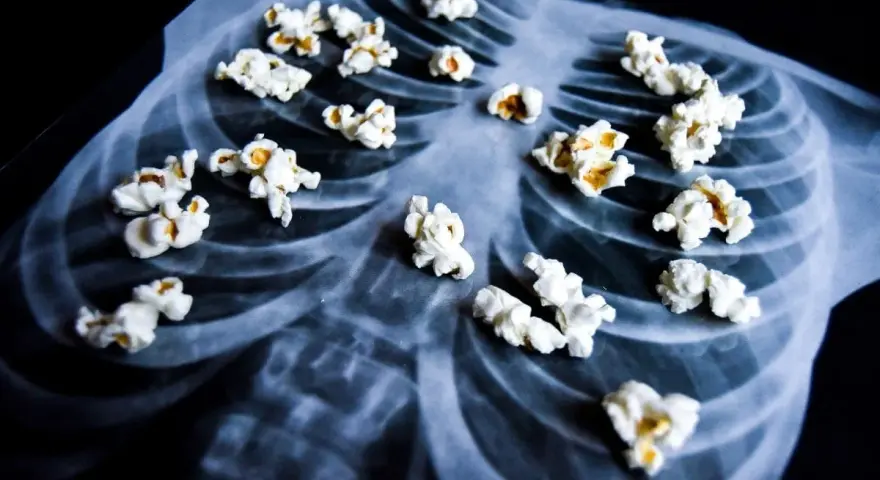Palomitas de maíz sobre una radiografía de tórax, evocando el peligro del diacetilo en el vapeo.