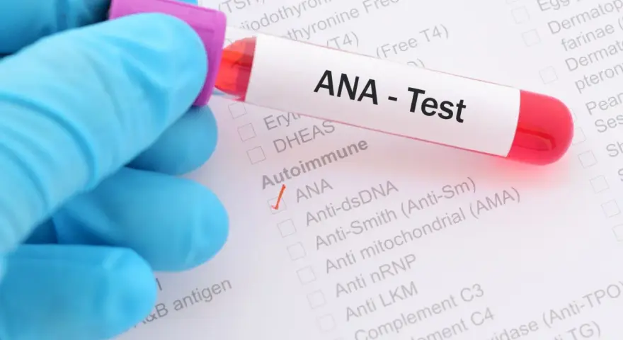 Ręka w niebieskiej rękawiczce trzyma probówkę z krwią do testu ANA. Na formularzu zaznaczono ANA.