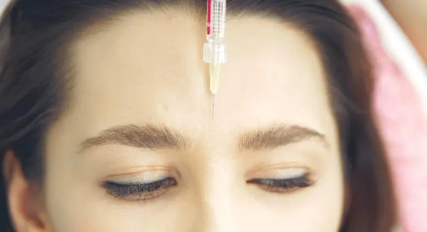 Una jeringa con aguja fina se acerca a la frente de una mujer, mostrando el procedimiento de **que es el botox** para suavizar arrugas.