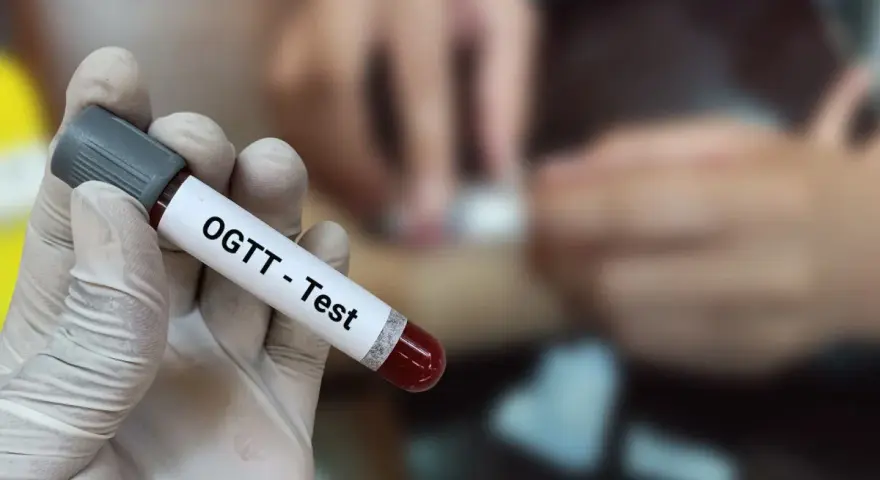 Ręka w rękawiczce trzyma probówkę z krwią z oznaczeniem "OGTT - Test". W tle widać proces pobierania krwi, kluczowy dla test obciążenia glukozą 75g interpretacja wyników.