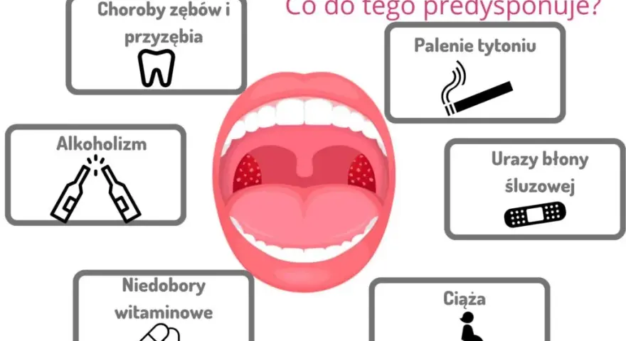 Skuteczne płukanki na stan zapalny jamy ustnej, które przynoszą ulgę