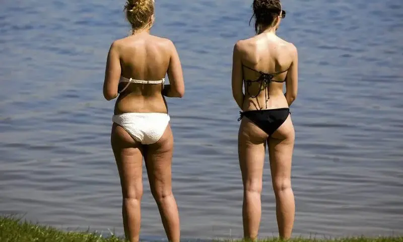 Jak ukryć cellulit na plaży? Skuteczne sposoby na pewność siebie