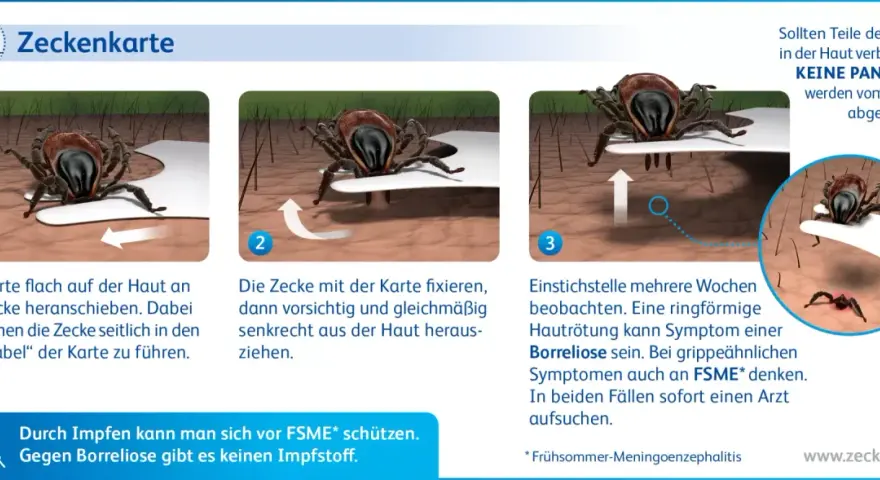 Anleitung zur Zeckenentfernung mit einer Karte: flach unter die Zecke schieben, fixieren und senkrecht herausziehen. Beobachten Sie die Stelle.