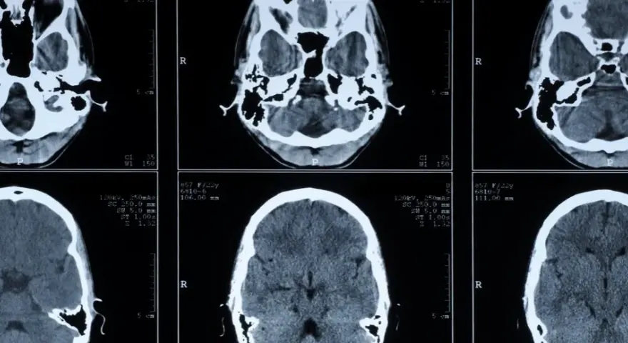 Die Bedeutung der medizinischen Diagnostik für präzise Krankheitsdiagnosen