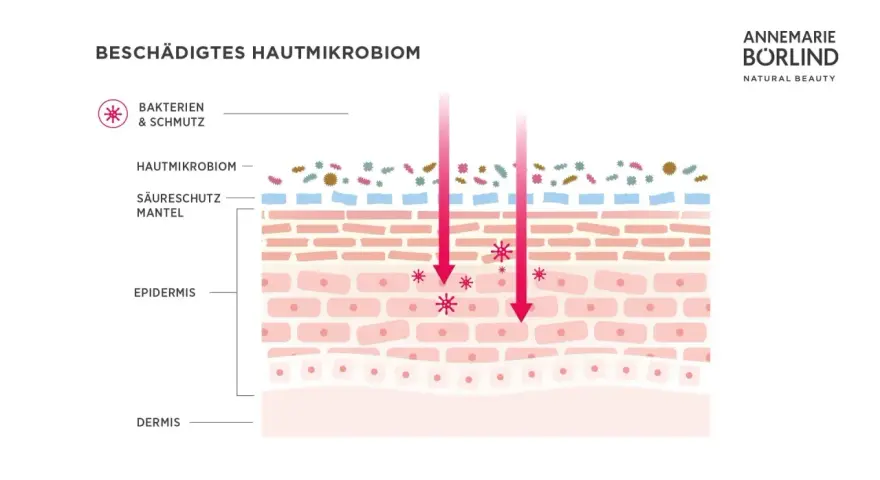 Illustration zeigt ein geschädigtes Hautmikrobiom mit Bakterien und Schmutz, die in die Epidermis eindringen.